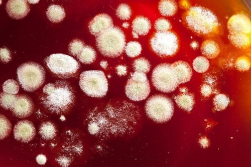 Половые грибковые инфекции и как вылечить