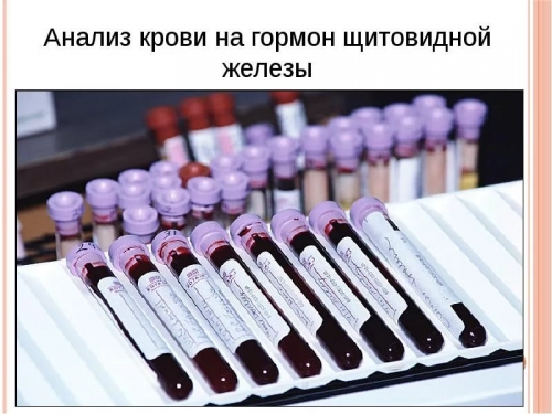 Скрининг анализ крови на гормоны thumbnail