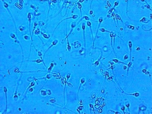 Микроскопическая картина спермограммы без патологии