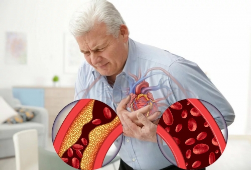 Ишемический инфаркт почки причины
